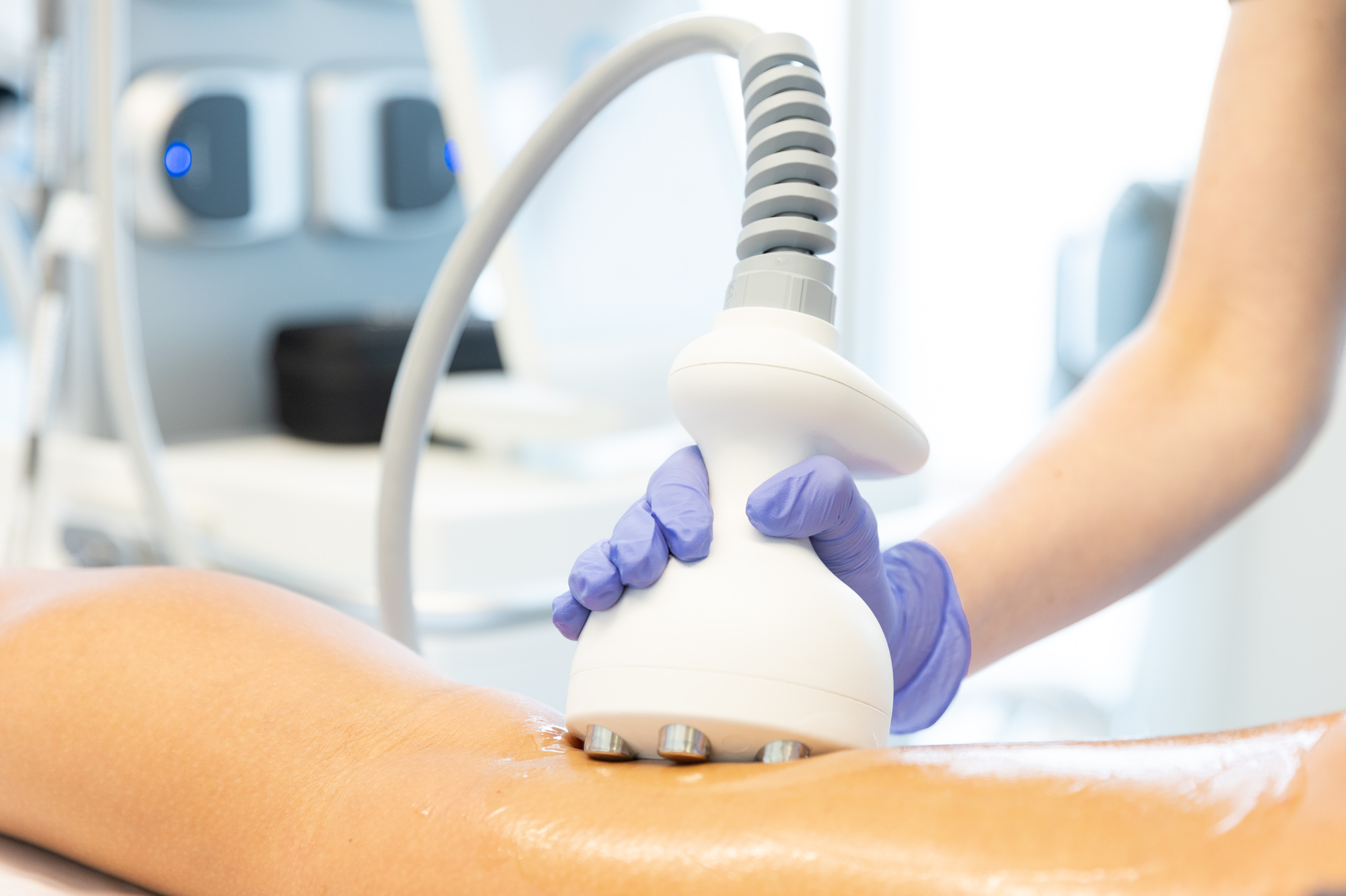 A patient gets a Venus Bliss treatment at their appointment for body contouring in Cleveland